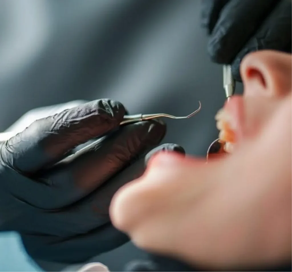 Frequently asked questions about oral surgery at Top Dental